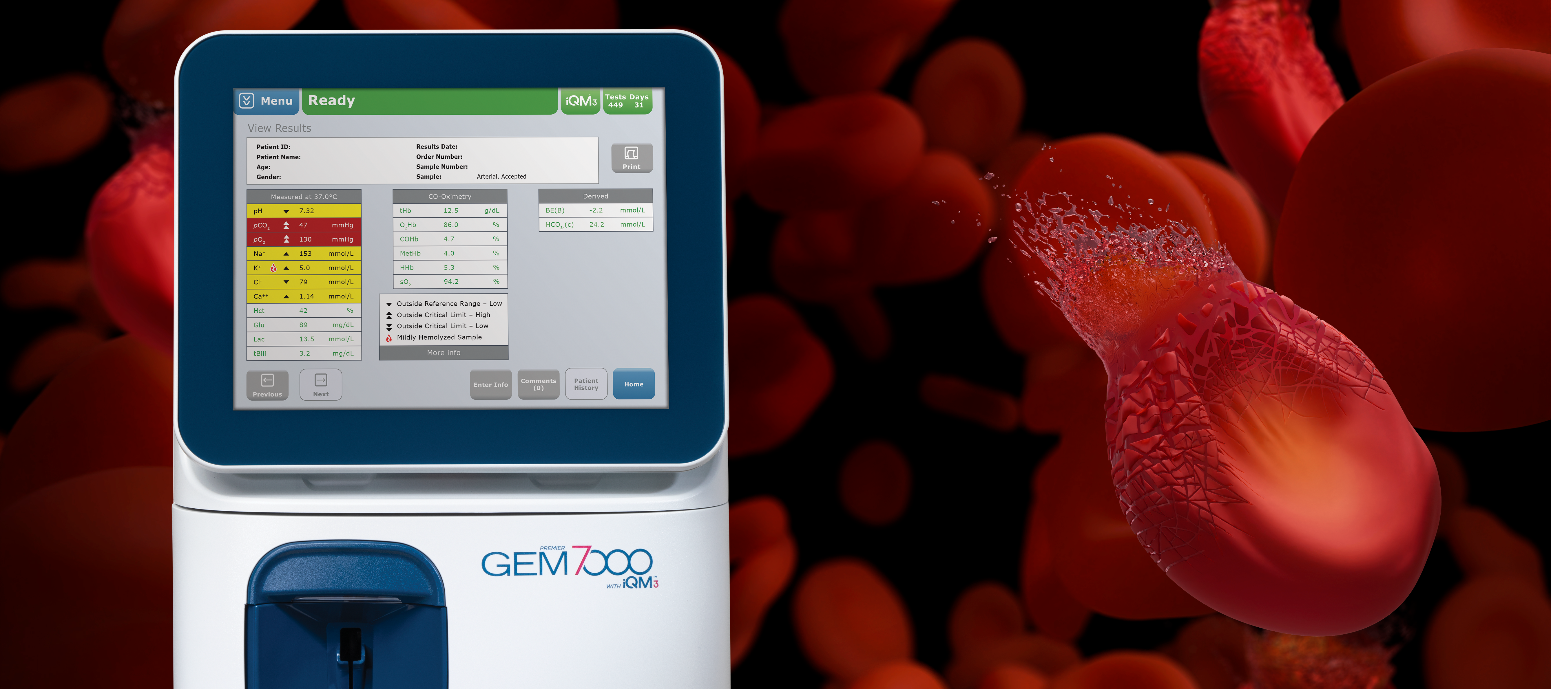 GEM® Premier™ 7000